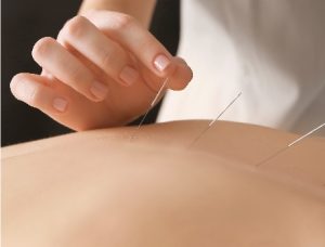 osteopath acupuncture tweed heads