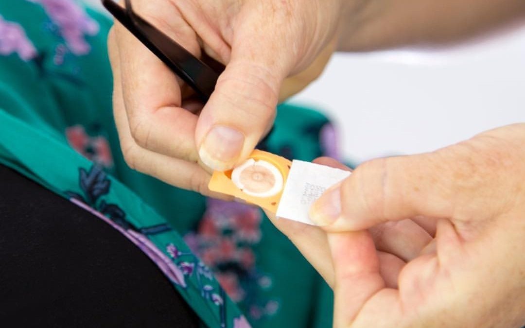 labour induce pregnancy acupuncture coolangatta tweed