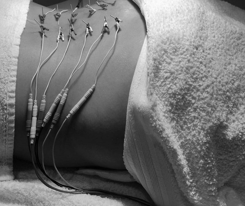 acupuncture lower back lumbar pain