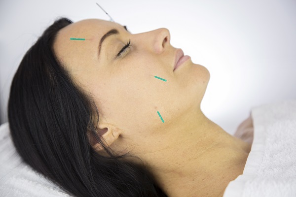 acupuncture face tighten neck skin