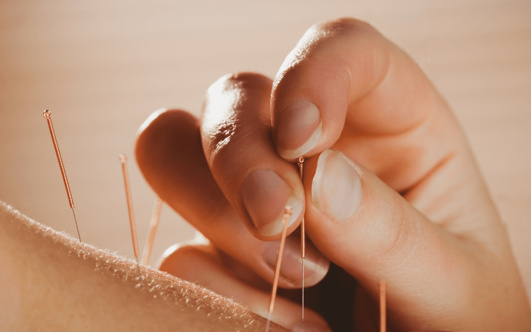 fertility acupuncture near me tweed heads