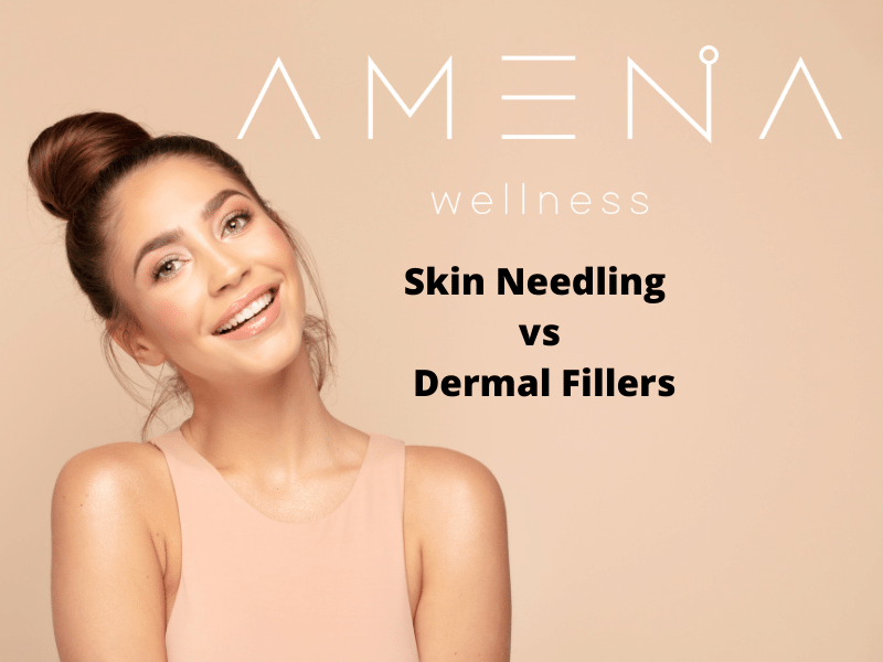 Why Skin Needling is Better Than Derma Fillers